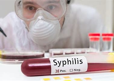 guys-how-to-know-when-you-are-infected-with-syphilis