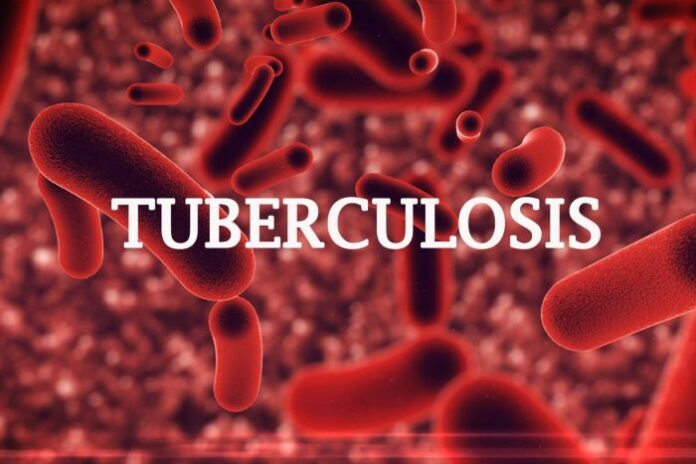 read-how-tuberculosis-killed