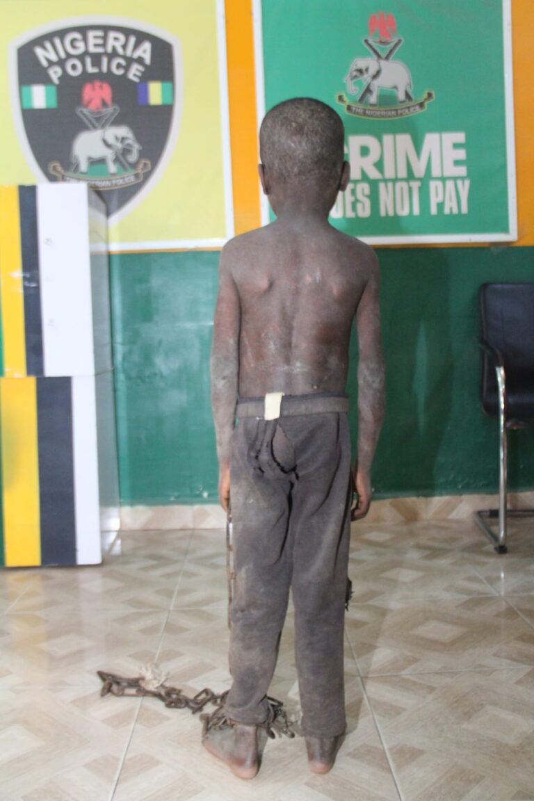 Nigeria police rescue 5-year-old chained & starved by father Nigeria police rescue 5-year-old chained & starved by father