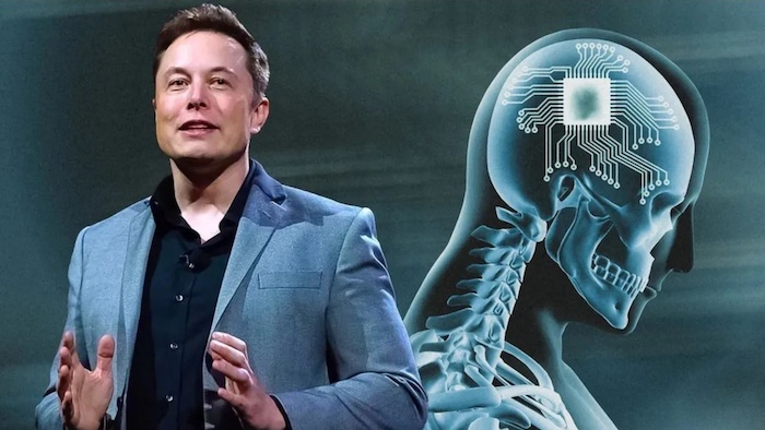 Musk’s brain chip that can help blind people see gets approval